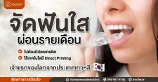 จัดฟันแบบใสรายเดือนไม่ต้องมีบัตรเครดิต