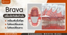 จัดฟันด้านใน Brava ไม่ต้องเปลี่ยนลวด ใหม่ล่าสุดของโลก